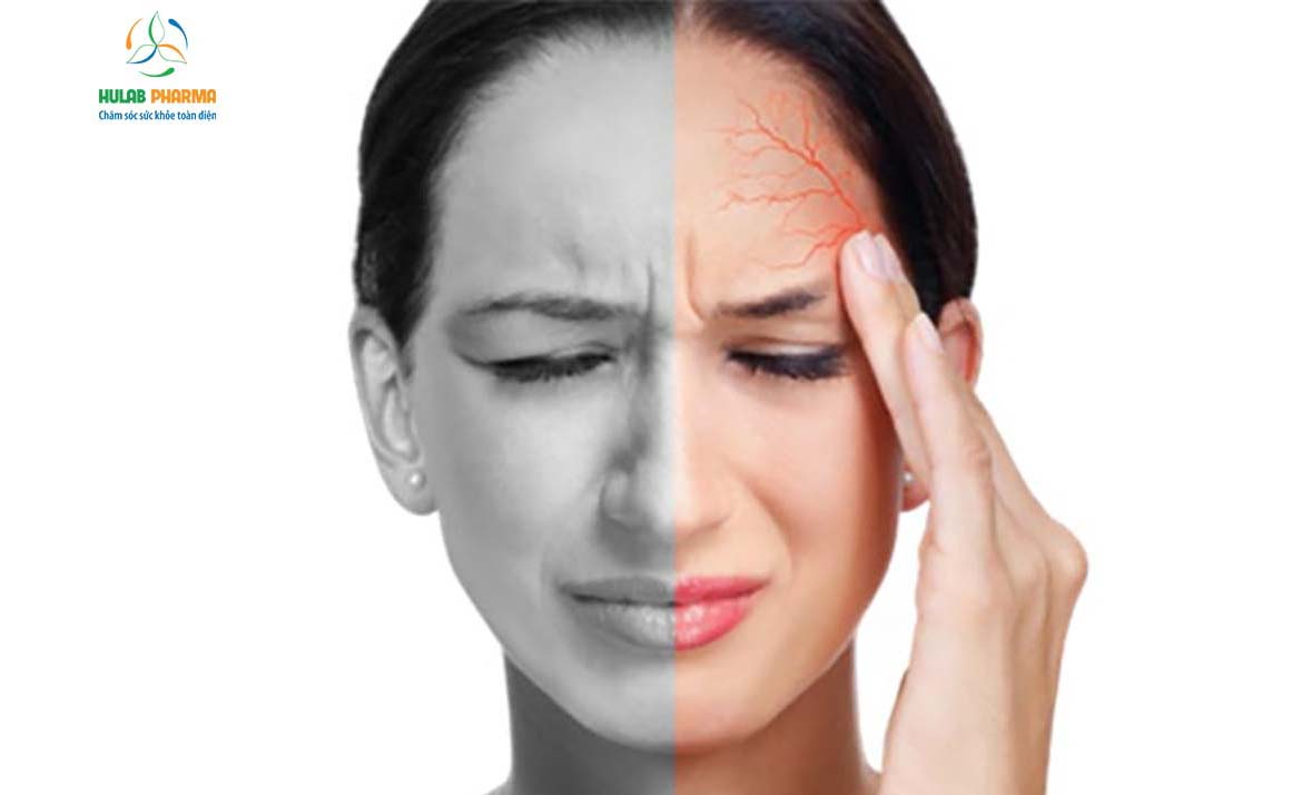 16 Nguyên nhân kích hoạt hội chứng đau nửa đầu bạn nên biết
