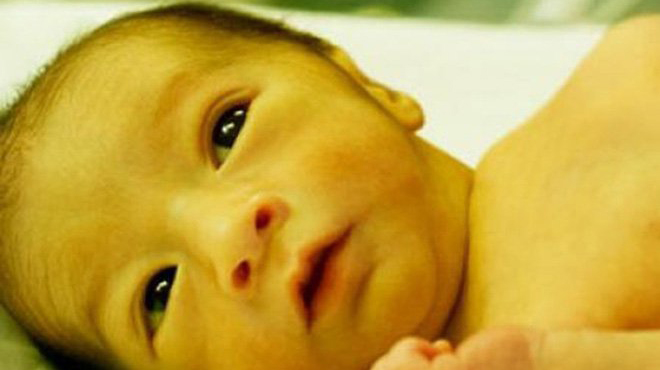 Vàng da ở trẻ sơ sinh – Nguyên nhân, cách nhận biết, điều trị và phòng ngừa